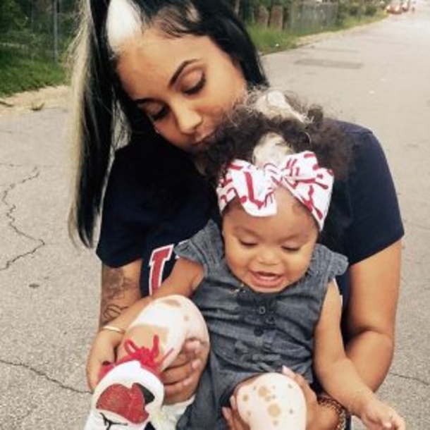The Girl Born With White Hair Forelock Is A Real Star On The