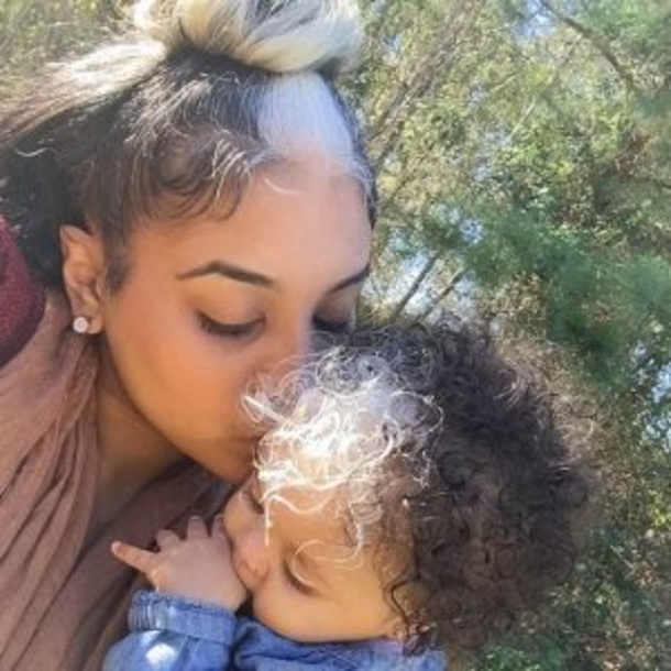 The Girl Born With White Hair Forelock Is A Real Star On The